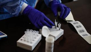 Μάχη για τα rapid tests: Απεμπλοκή των φαρμακοποιών ζητούν διαγνωστικά και εργαστηριακοί γιατροί 