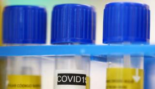 Θωμαΐδης για Covid-19: Δεν υπάρχει περίπτωση να μην νοσήσει κάποιος ανεμβολίαστος